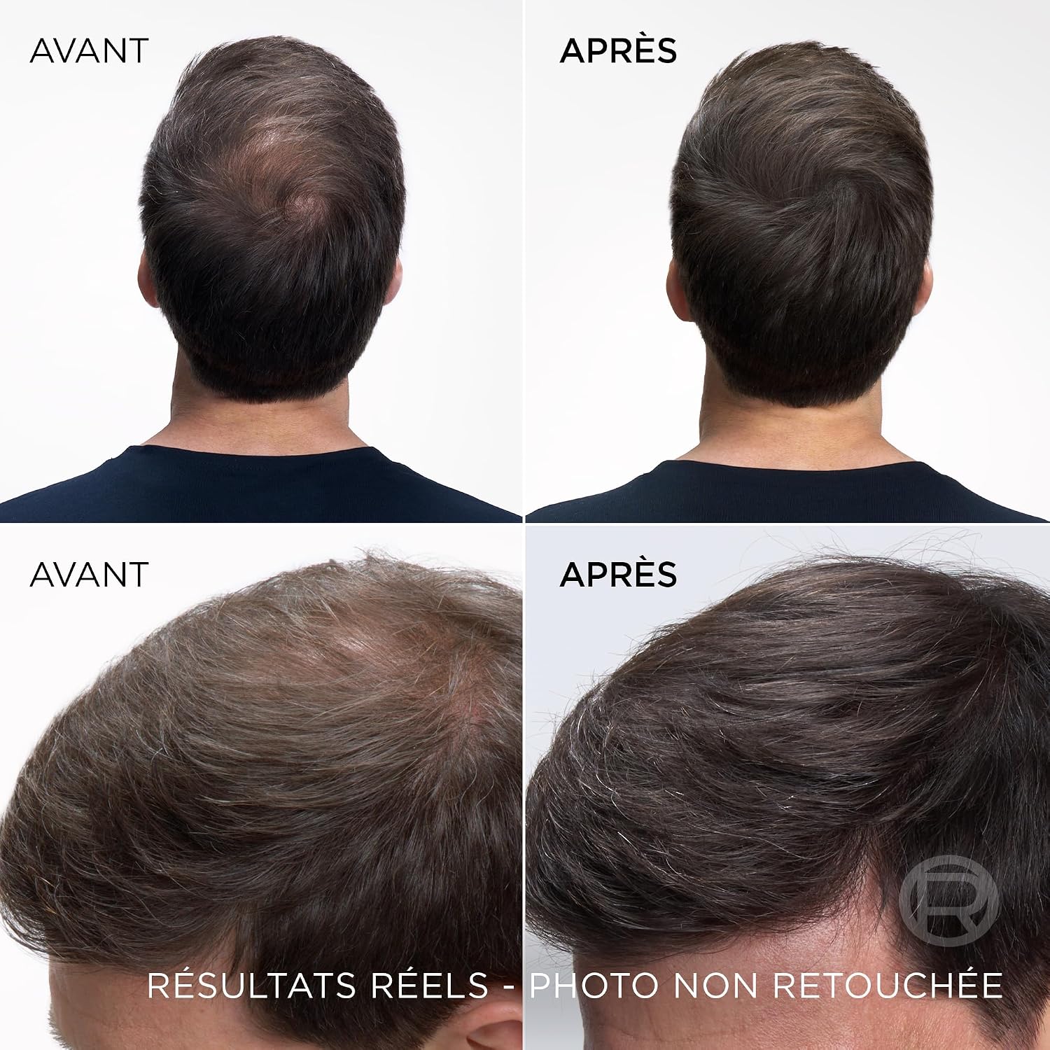 L’ORÉAL PARIS Magic Retouch — Spray correcteur racines 2x75 ml – Image 3