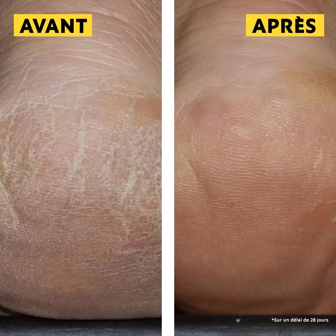 ALVADIEM — Soin protection intense pieds très secs 100 ml – Image 7