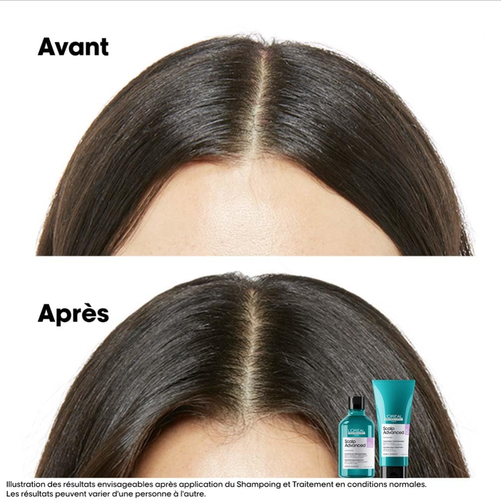 L'OREAL PROFESSIONNEL Scalp Advanced — Shampoing recharge 500 ml – Image 4