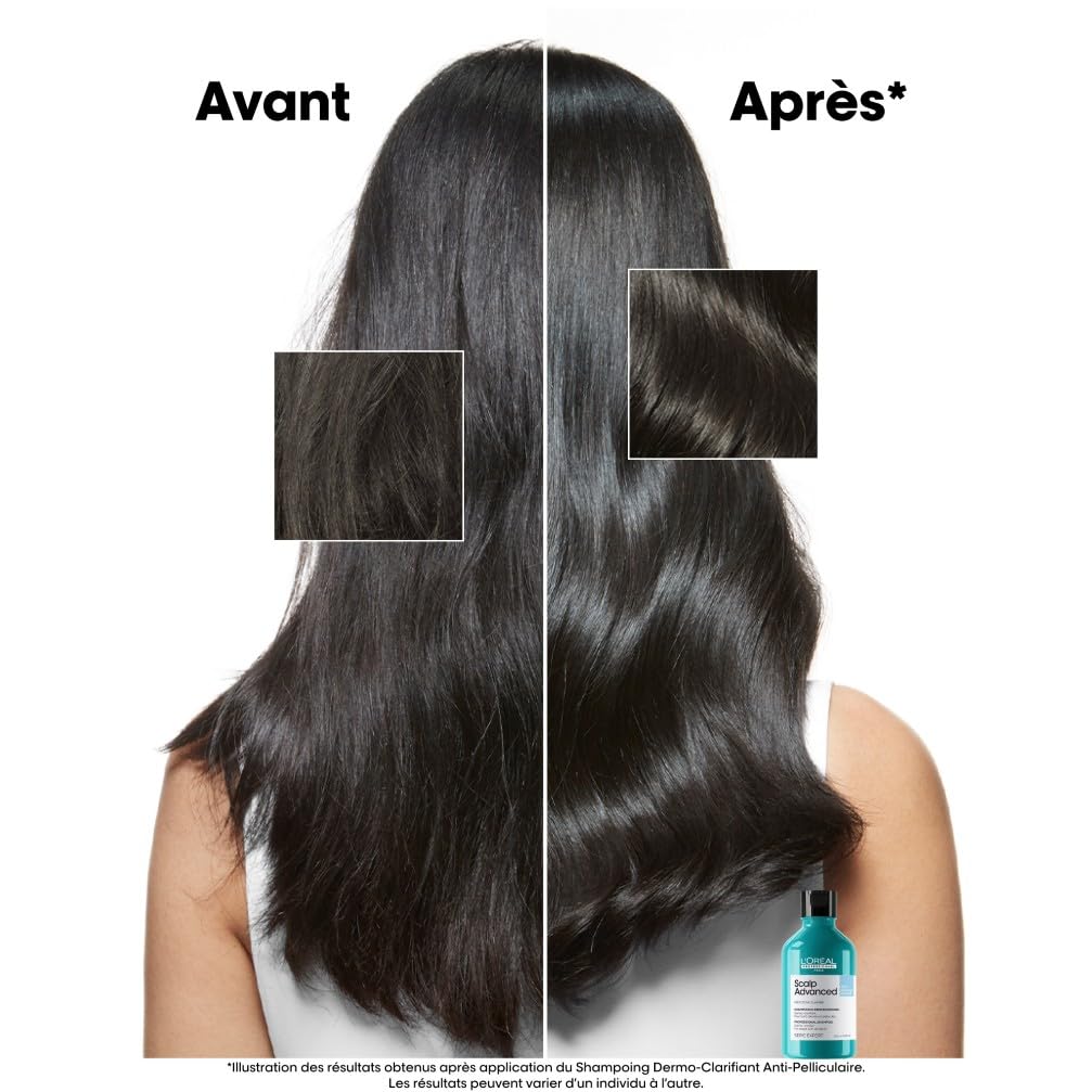 L'ORÉAL PROFESSIONNEL Scalp Advanced — Shampoing antipelliculaire 500 ml – Image 3