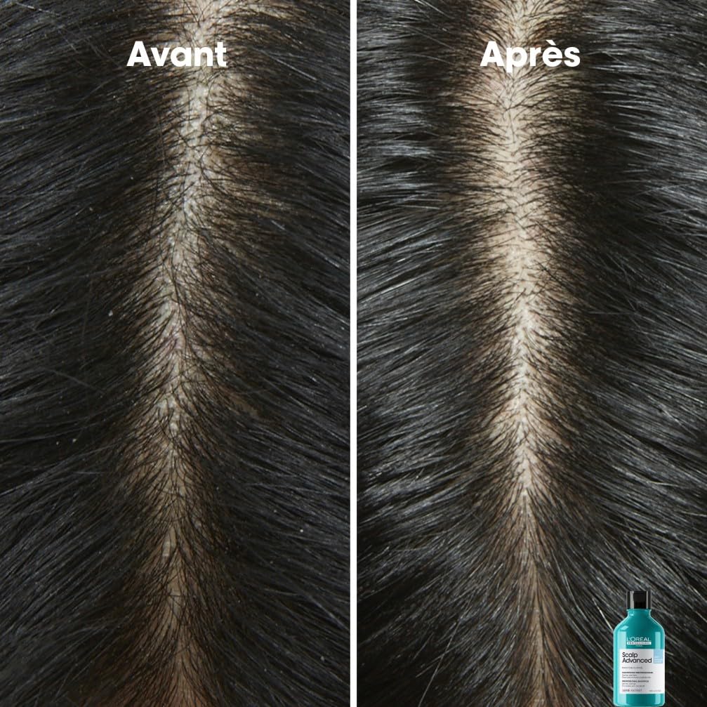 L'ORÉAL PROFESSIONNEL Scalp Advanced — Shampoing antipelliculaire 500 ml – Image 4